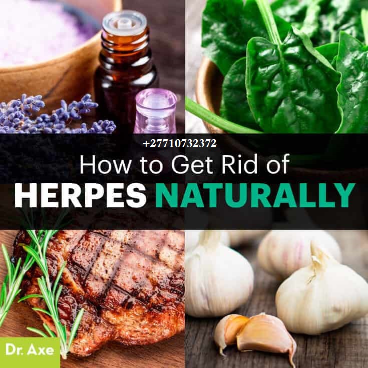 Herbal Products For The Treatment Of Herpes In Frontenac City in Missouri And Houston City In Texas, United States Call ✆ +27710732372 Get Rid Of Chronic Inflammatory Diseases In San José de las Matas In Dominican And Potchefstroom City In South Africa